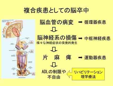 http://www.seijoh-u.ac.jp/blog/physical/7d93360b756122f0ac65d7126234cc69f42d3a8f.jpg